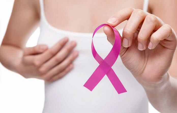cancer de mama