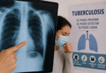 Aumento de casos de tuberculosis: cómo gestionar un subsidio de la provincia para sostener la medicación