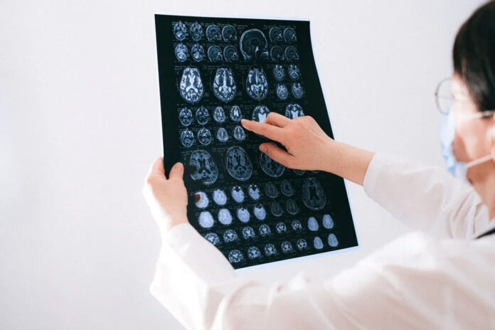 cerebro